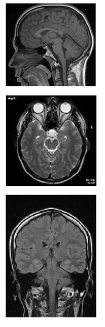 Three MRT images