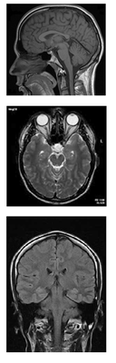 Three MRT images