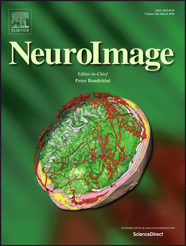 Article selected as cover of NeuroImage 128